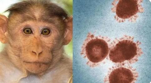 猴痘